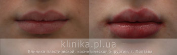 губы 1 копия.jpg