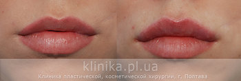 губы3.jpg