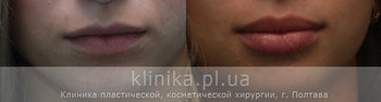 губы4.jpg