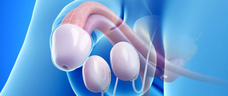 Types of implants and features of testicular prosthetics