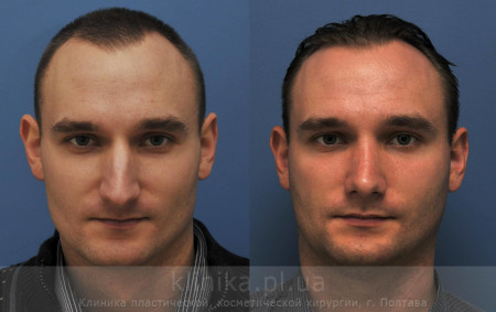 Фото до і після - чому важливо фотографувати пацієнта