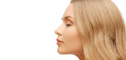 Rhinoplasty of the tip of the nose in Poltava, Kiev and Kharkov - photo 2
