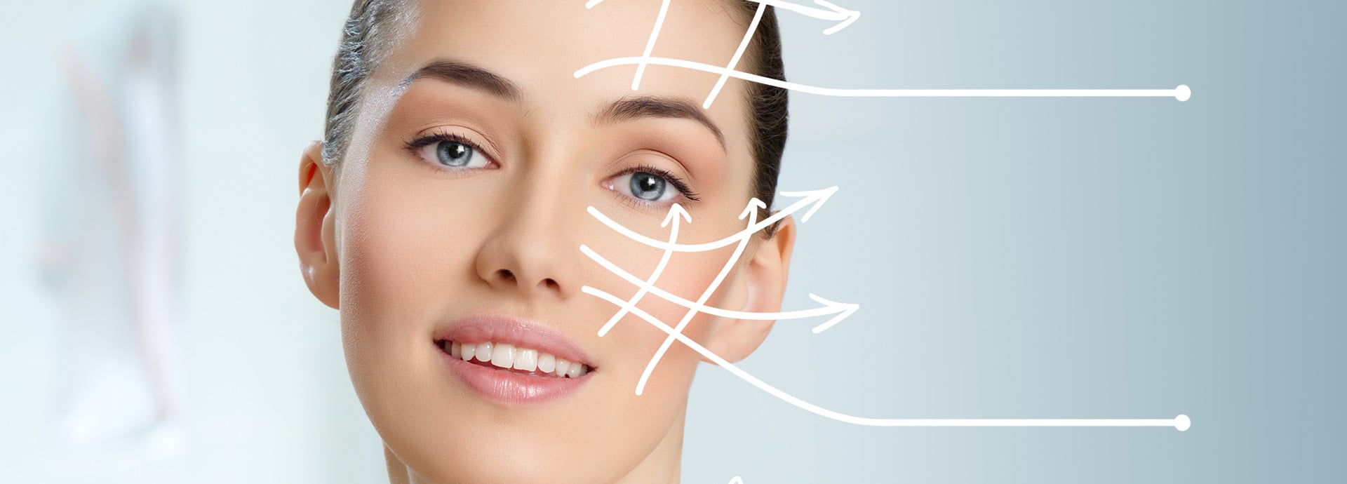 What sutures are better for the facelifting