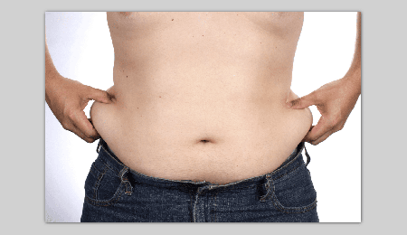 Liposuction for men: What are its aspects?