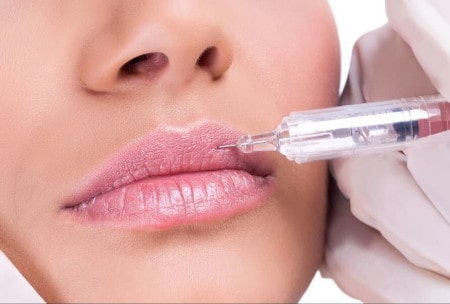 Herpes after lip augmentation - what to do?