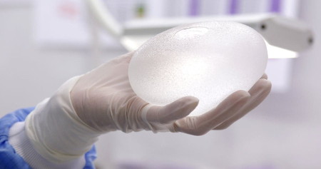 Mammoplasty: when will the implants go down?