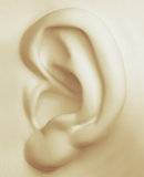 Ear surgery (otoplasty)