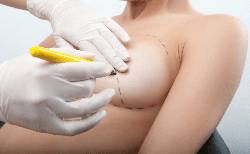 Breast asymmetry: causes and methods of treatment