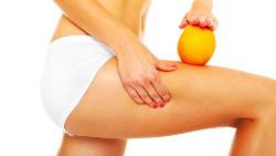 Myths about liposuction