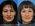 Tagliacotian surgery - Rhinoplasty Tagliacotian surgery - Rhinoplasty